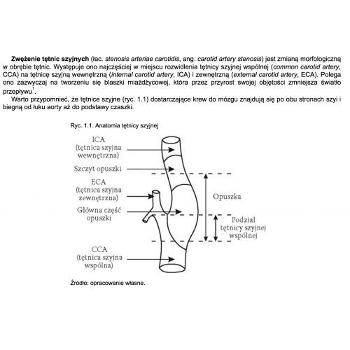 produkt - Jakość życia chorych po rewaskularyzacji krytycznego zwężenia tętnicy szyjnej wewnętrznej